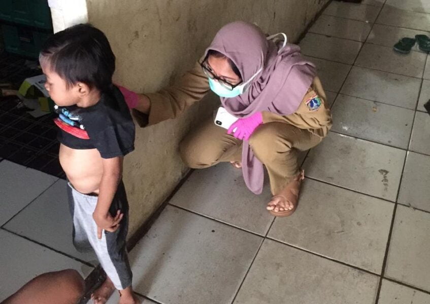 IMG-20200921-WA0053 Wali Kota Jakut Peduli Derita Bocah Miskin Berpenyakit Benjol Tulang Punggung 3