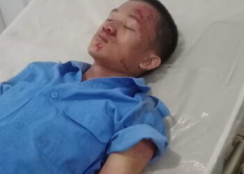 Jalan Rusak dan Gelap di Desa Cengal Kab Kuningan, Makan Korban Sampai Pingsan 19