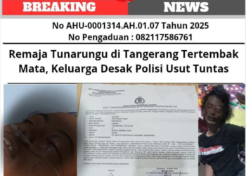 Remaja Tuna Rungu Tertembak Matanya di Tangerang, Keluarga Desak Polisi Usut Tuntas 16