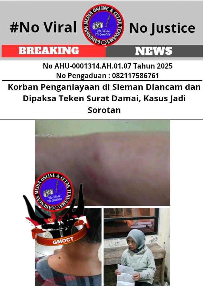 Korban Penganiayaan di Sleman Diancam dan Dipaksa Teken Surat Damai, Kasus Jadi Sorotan 1 Korban Penganiayaan di Sleman Diancam dan Dipaksa Teken Surat Damai, Kasus Jadi Sorotan 1