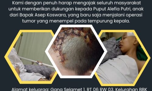 GMOCT: Gabungan Media Online dan Cetak Ternama "AJAKAN DONASI UNTUK PUPUT ALEFIA PUTRI" 2